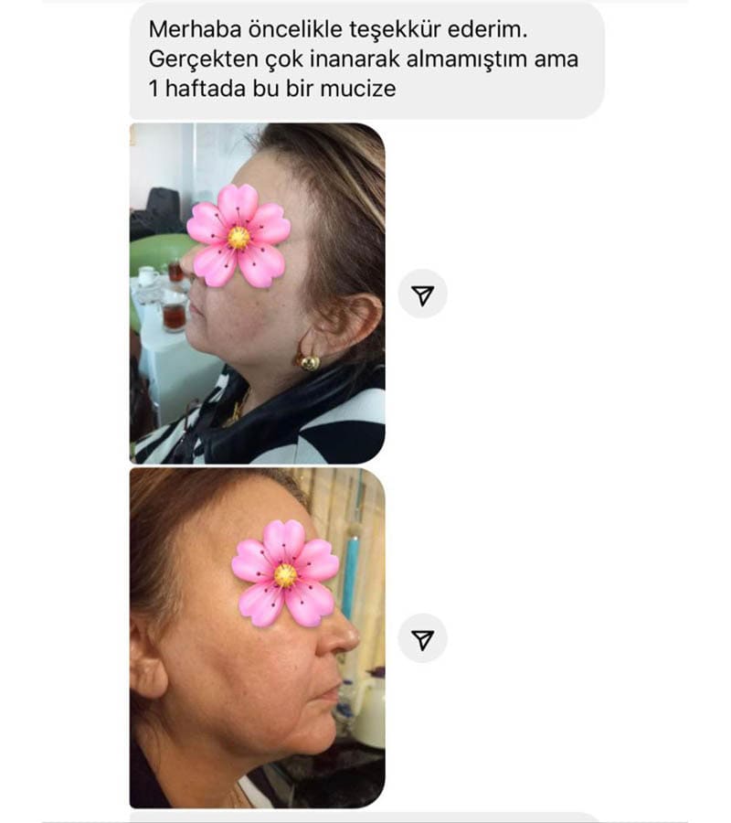 lekesiz ciltler 1